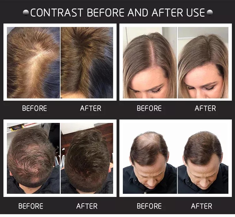 28g haarversterkende vezels wo - Hair Care Natural Products recensie en prijs
