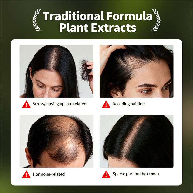 Natuurlijke Haargroei Set Usma - Hair Care Natural Products recensie en prijs