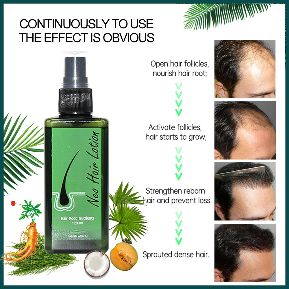 Originele Neo Haarlotion 120 m - Hair Care Thailand recensie en prijs