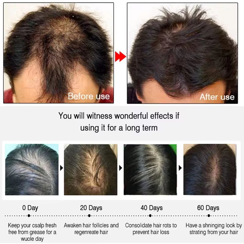Snelle gember haar groeispray, - Hair Care Natural Products recensie en prijs